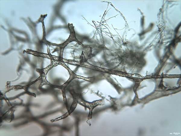 A blood vessel network recovered from the tibia of a T. rex dinosaur fossil is seen with a light microscope.